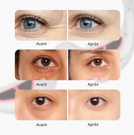 Avant après effet lunette de massage pour les yeux